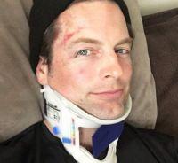 Michael Muhney (ex Adam Newman dans les Feux de l'Amour) blessé lors d'une course cycliste